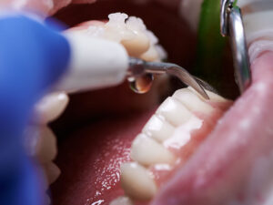 periodontia