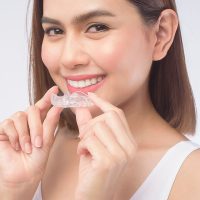 Alinhadores transparentes